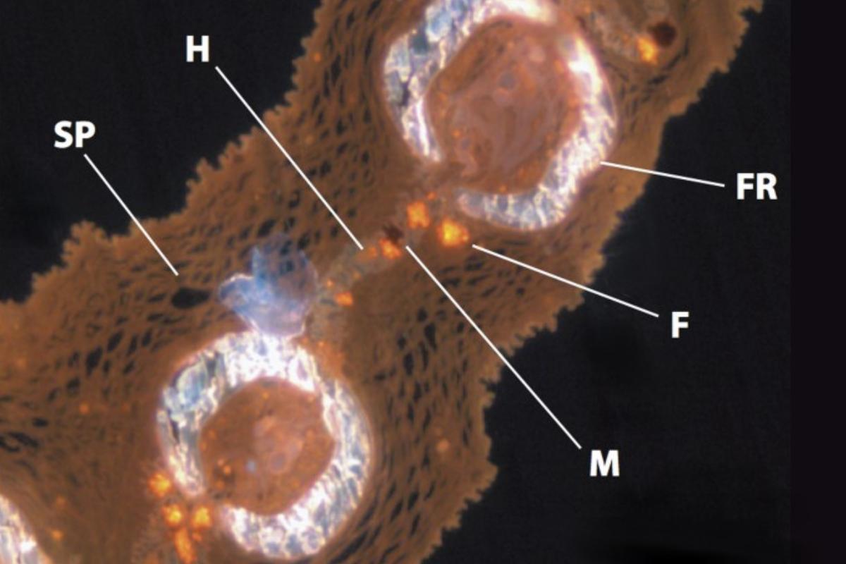 CHROMATOPHORES DÉFINITION, FONCTION et CLASSIFICATION
