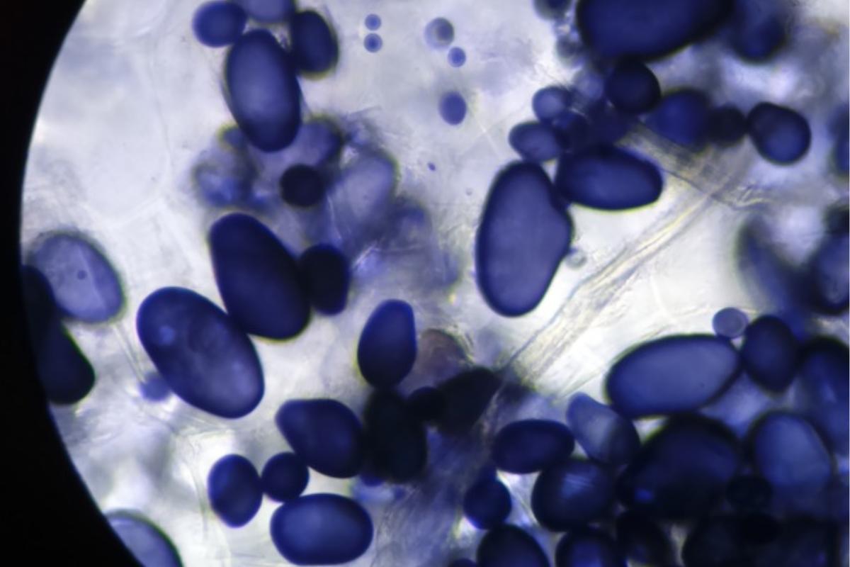 Amyloplaste définition, fonction et structure