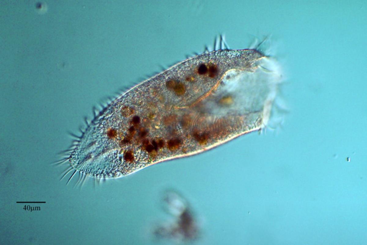 Protozoaires : définition, types et exemples