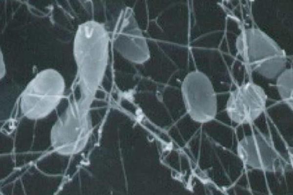 Chimiosynthèse : définition, phases et différence avec photosynthèse - Exemples d'organismes chimiosynthétiques